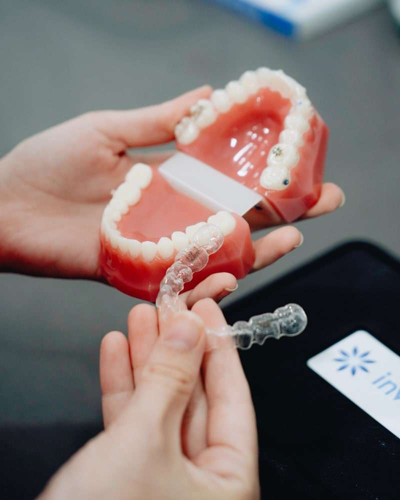 Invisalign kepong